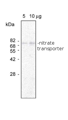 western blot using anti-nitrate transporter antibodies